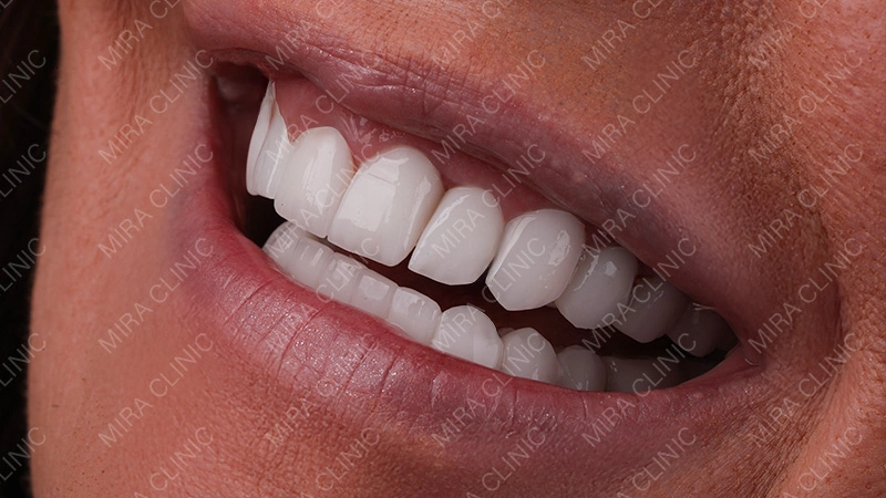 lip movement during speech